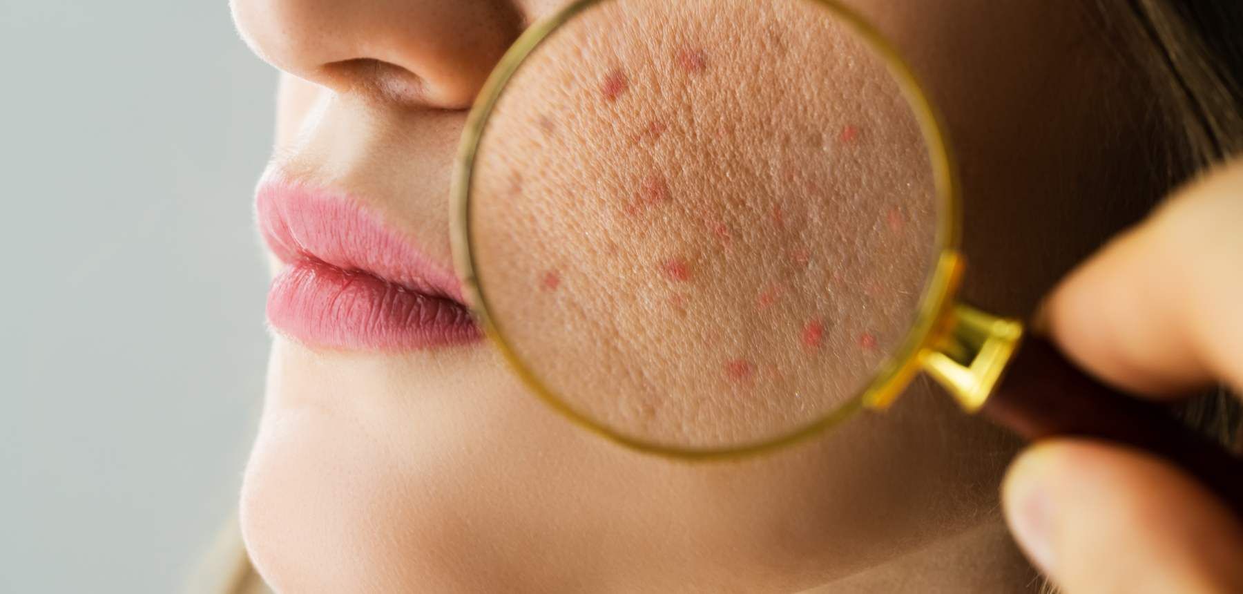 Bárbara Pereira Dermatologista