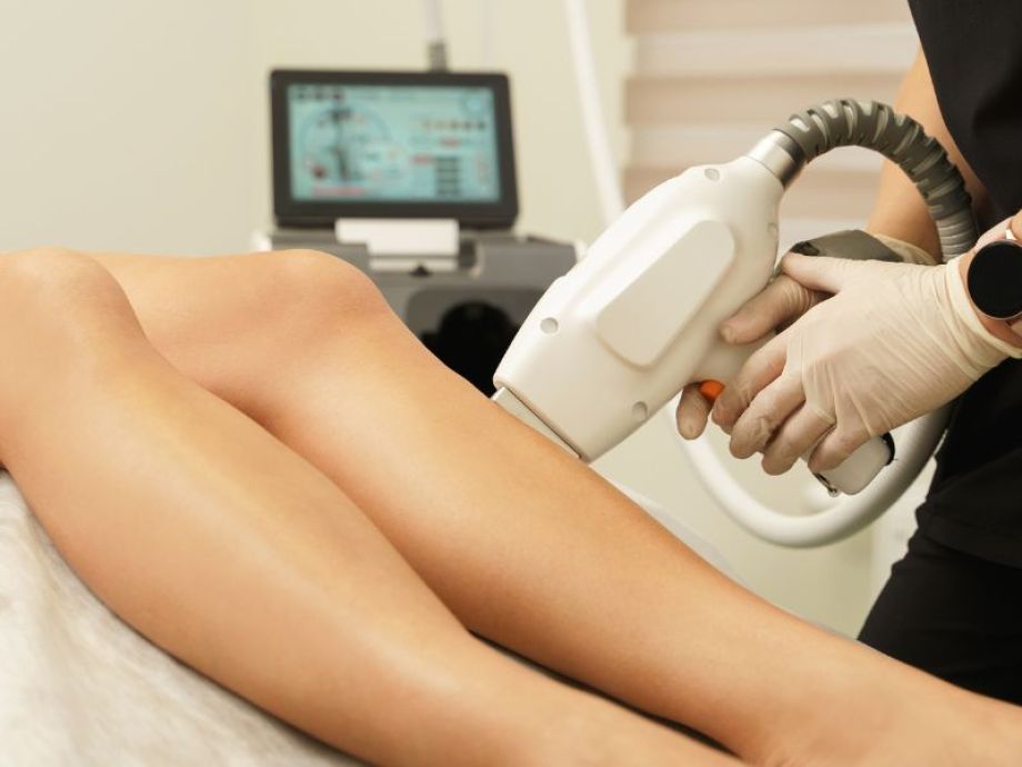 Fotodepilação SHR - Drª. Bárbara Pereira Dermatologista